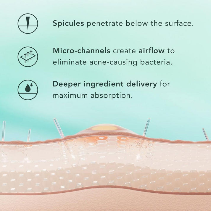 Opelle™ Spicule Serum