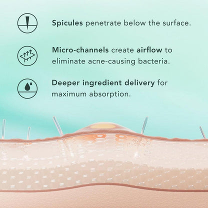Opelle™ Spicule Serum