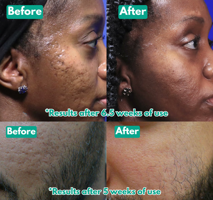Opelle™ Spicule Serum