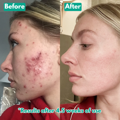 Opelle™ Spicule Serum