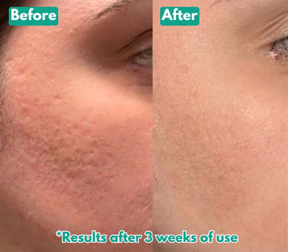 Opelle™ Spicule Serum